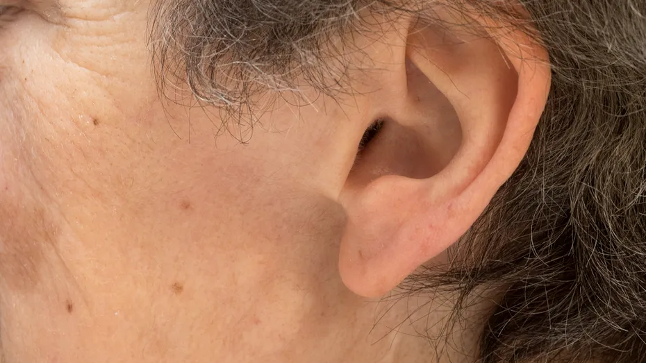 Semnele rinichilor bolnavi care se văd la urechi. La ce să fii atent când te uiți în oglindă