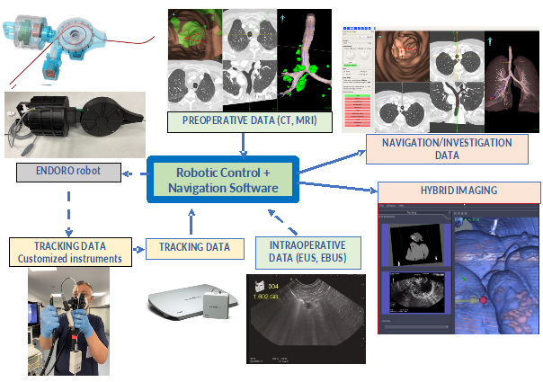 Sistemul IDEAR  construit îmbunătățeste diagnosticarea cancerului în cadrul procedurilor de endoscopie prin introducerea de noi tehnologii de imagistică hibridă, navigație electromagnetică și robotică medicală